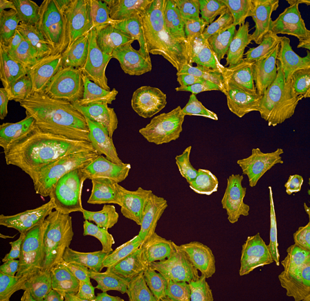 The “Cell Painting” method allows scientists to visualize cell changes upon chemical exposure. 