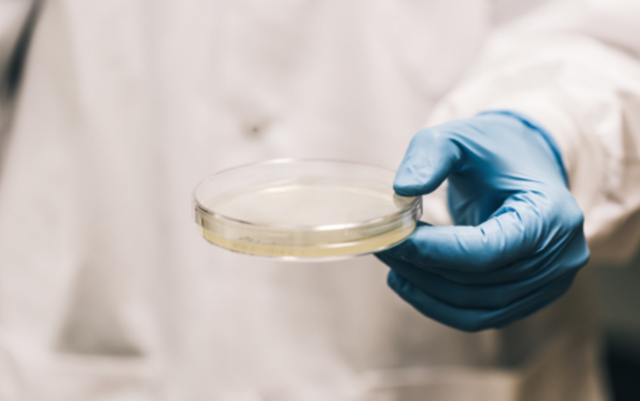 Photograph of scientist holding a petri dish.