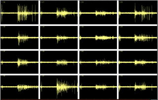 A snapshot of electrical activity in the "brain on a chip."